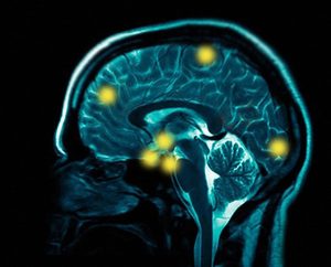 brain-scan