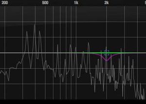 De-Esser (vocal analysis)