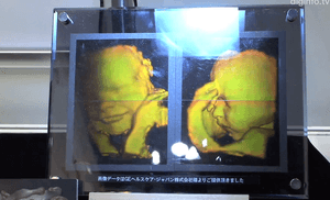 3d hologram baby angles