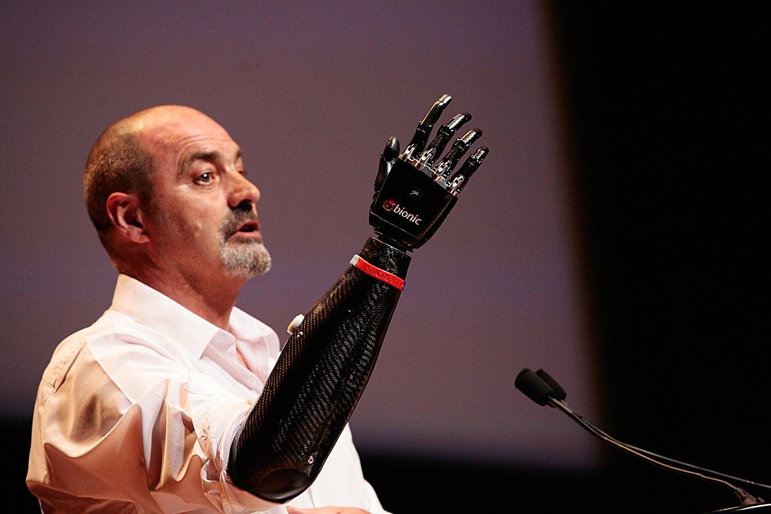 ge 2045 Nigel Ackland Bebionic3 artificial hand podium