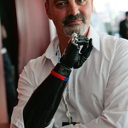 ge 2045 Nigel Ackland Bebionic3 artificial hand