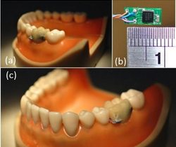 tooth-sensor-size