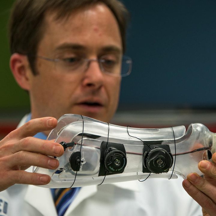 next gen artificial limbs put finger better life idigits 19