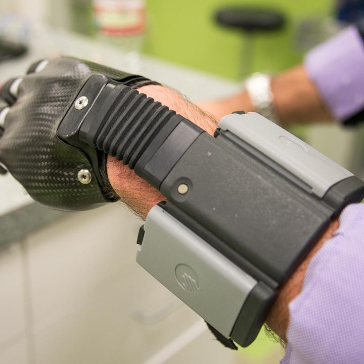 next gen artificial limbs put finger better life idigits 3