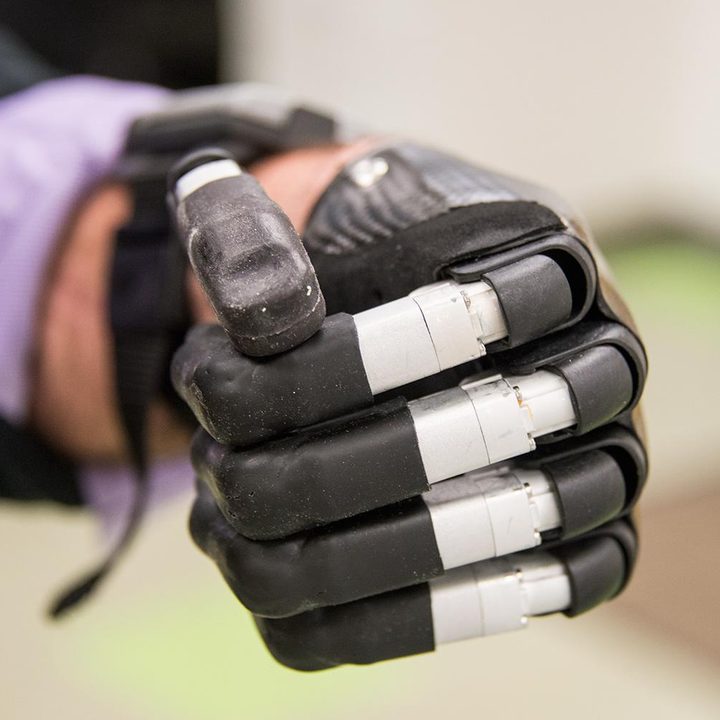 next gen artificial limbs put finger better life idigits 4