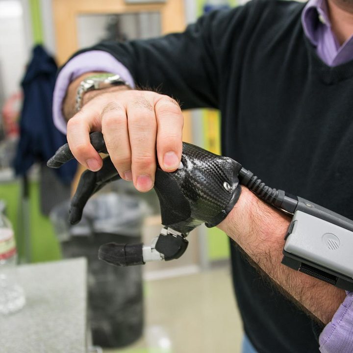 next gen artificial limbs put finger better life idigits 7