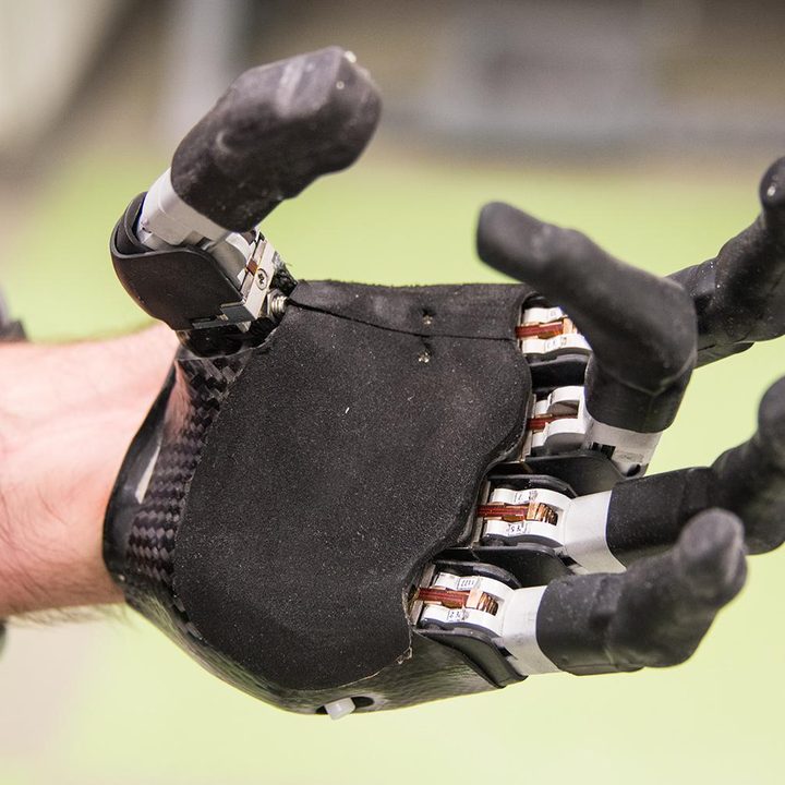 next gen artificial limbs put finger better life idigits