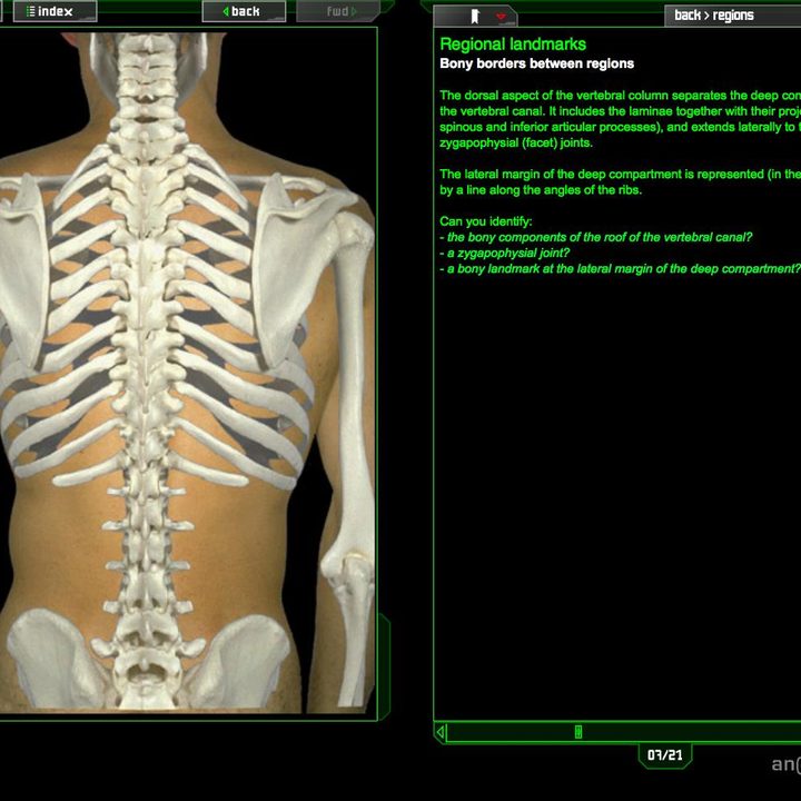 dead people problem doctors crave virtual cadavers br 07 0b screenshot