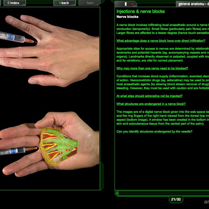 dead people problem doctors crave virtual cadavers gd 27b screenshot