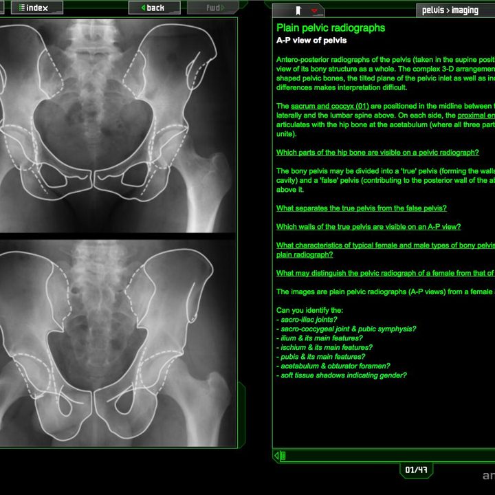 dead people problem doctors crave virtual cadavers pi 01 screenshot