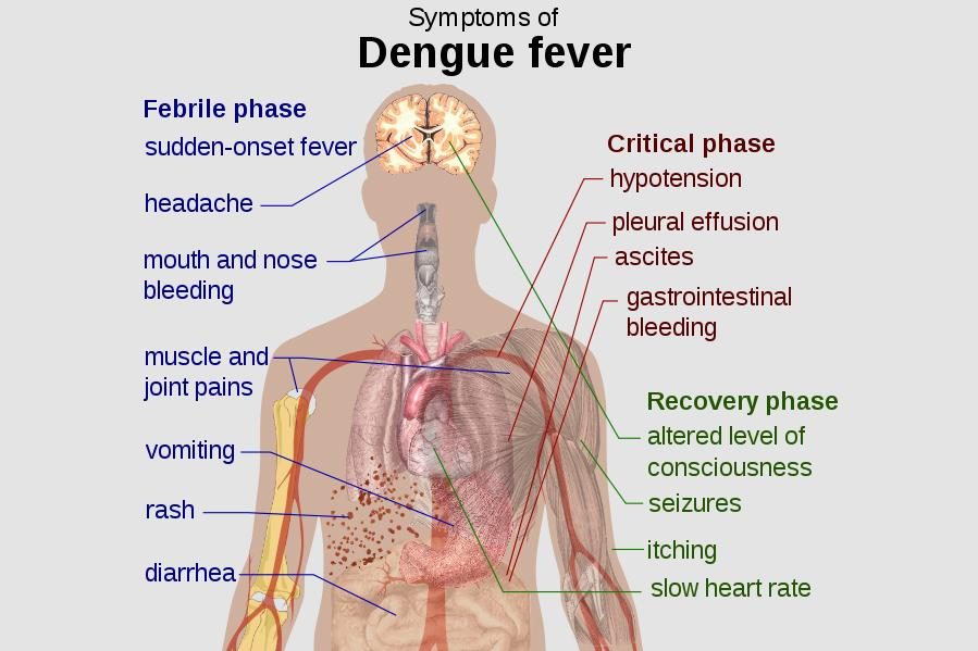 brazilian genetically modified mosquitos dengue fever pain