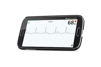 AliveCor AliveECG app Android