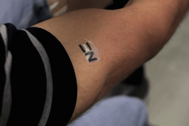 lactate battery tattoo