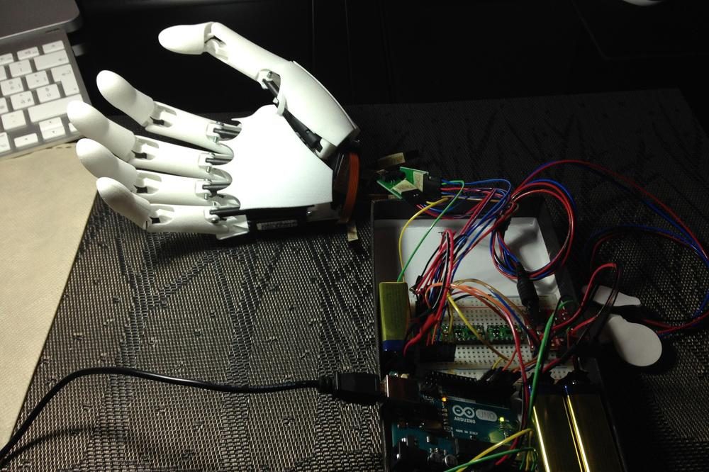 meet youbionic com worlds advanced artificial hand photoblog 012