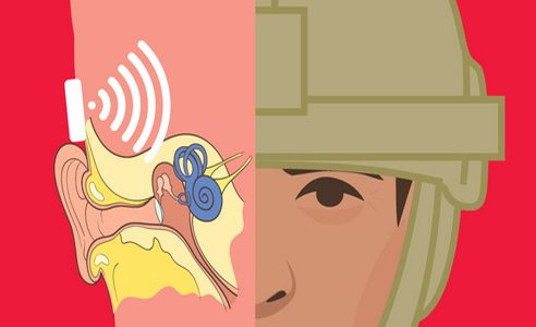 BAE_Systems-Bone_Conduction_v5