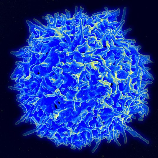 800px-Healthy_Human_T_Cell