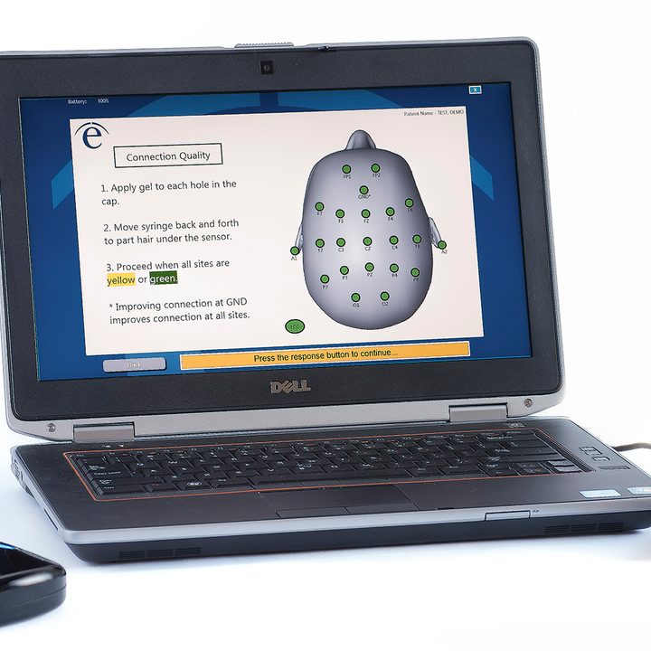 evox eeg brain reader from evoke neuroscience helps mma fighters device laptop setup