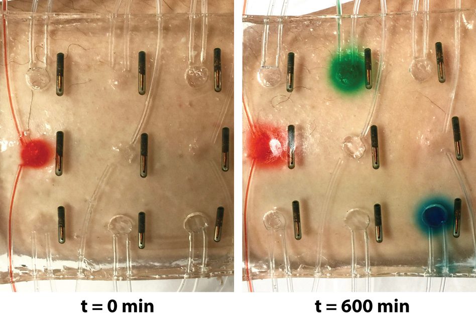 bandage of the future hydrogel delivers medicine automatically stretchable electronics 2