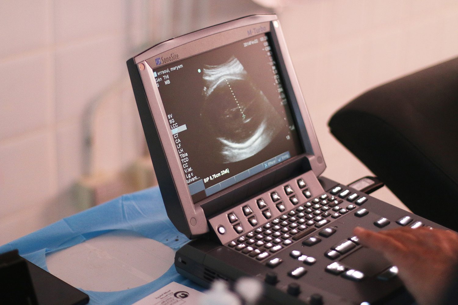 Mobile Ultrasound Patrol Project