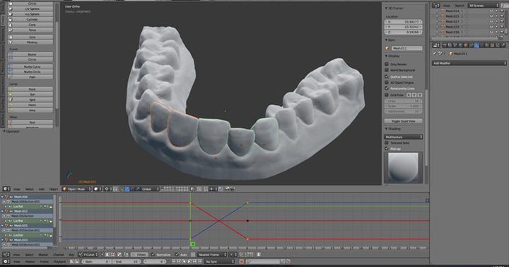 3D-printed-Invisalign_003