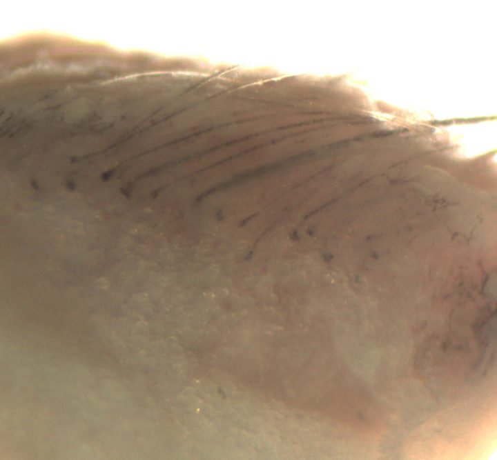 RIKEN's lab-grown skin as viewed under a microscope