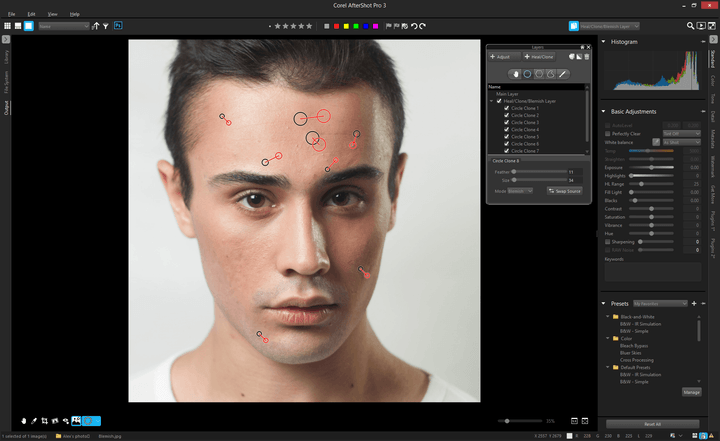 Blemish correction.