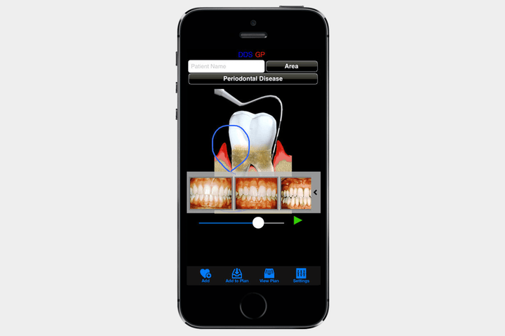 DDS GP for iPhone