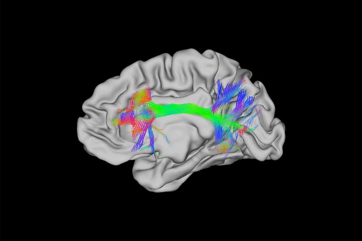 BrainMapping_header
