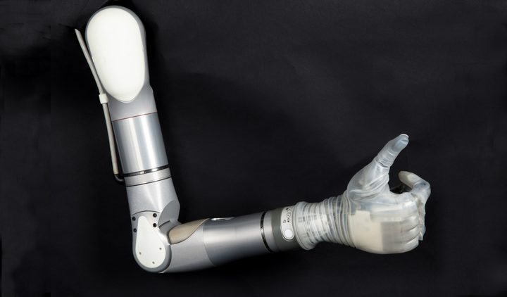 Luke prosthetic arm