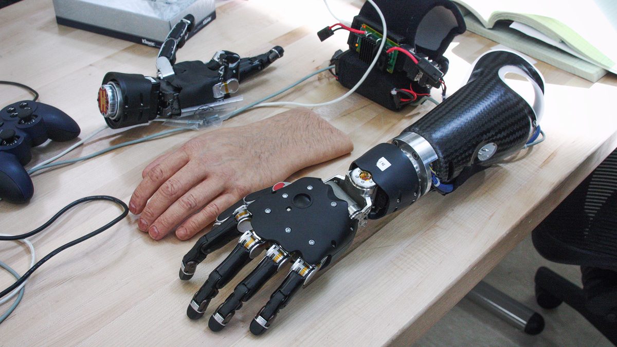 ONR Prosthetic