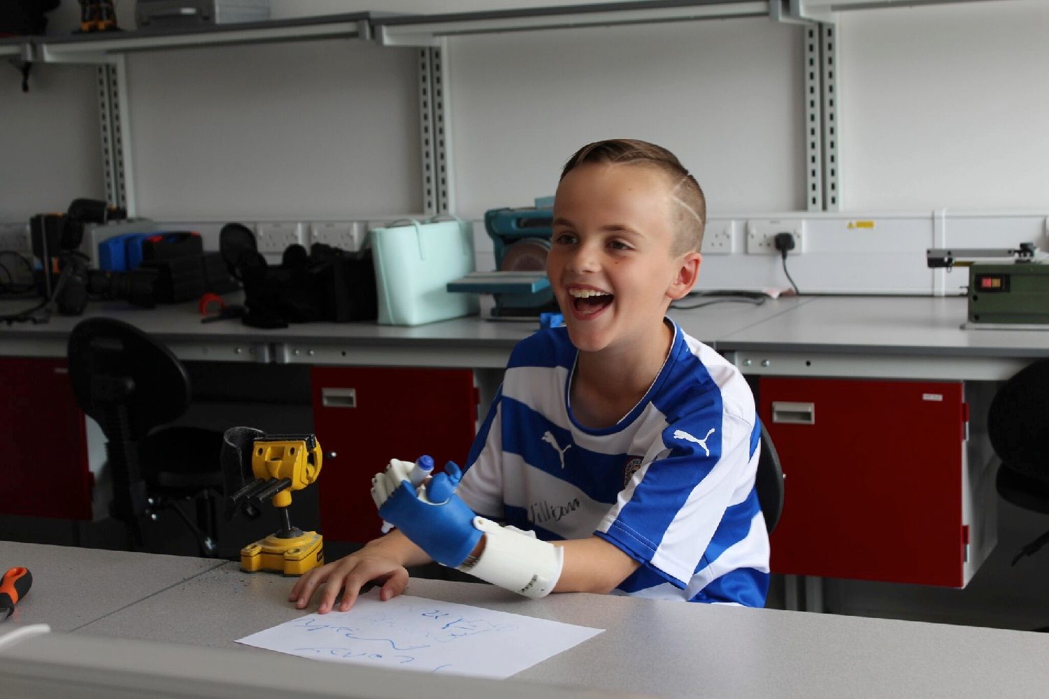 3d printed prosthesis soccer 3dprint5