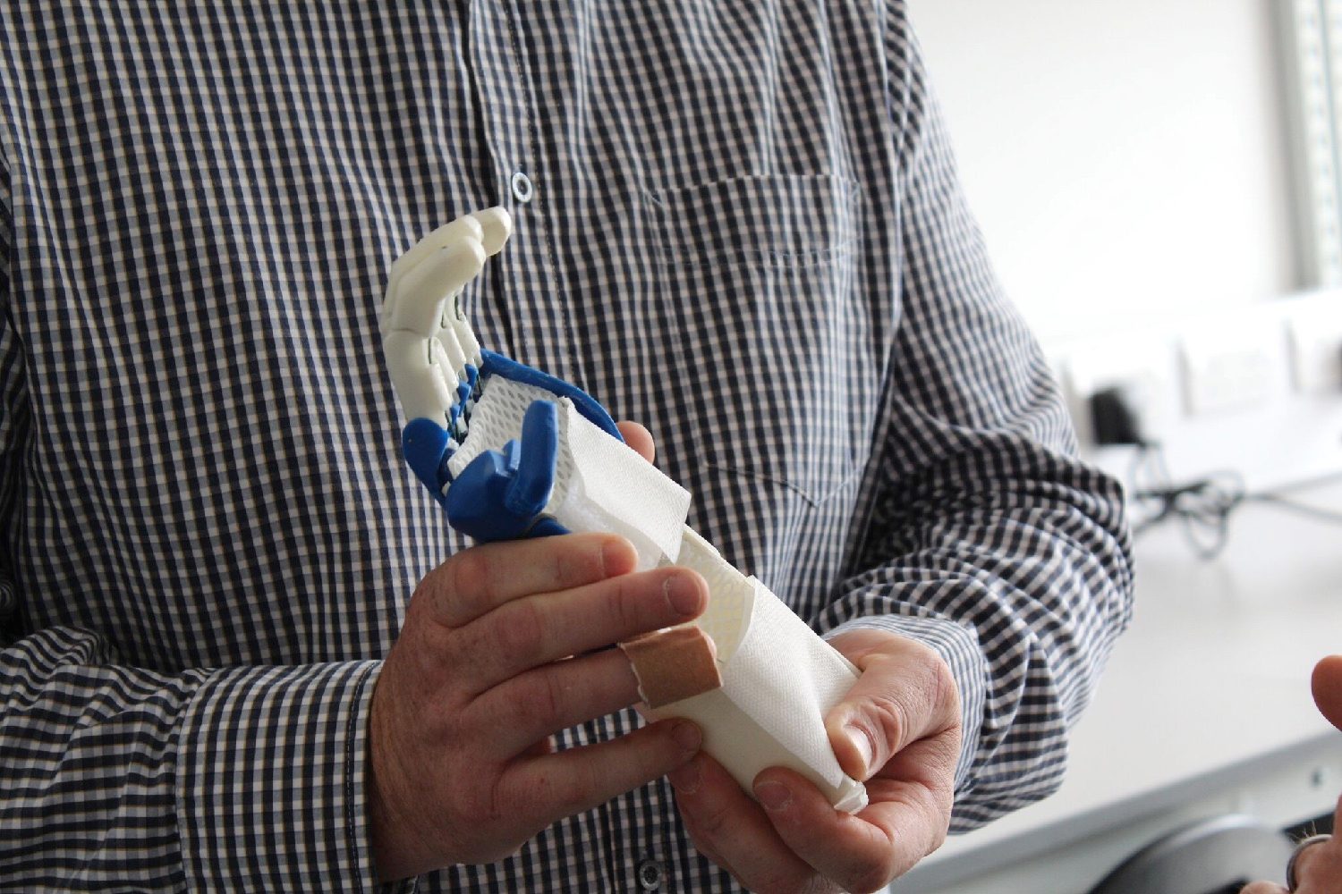 3d printed prosthesis soccer 3dprinthand