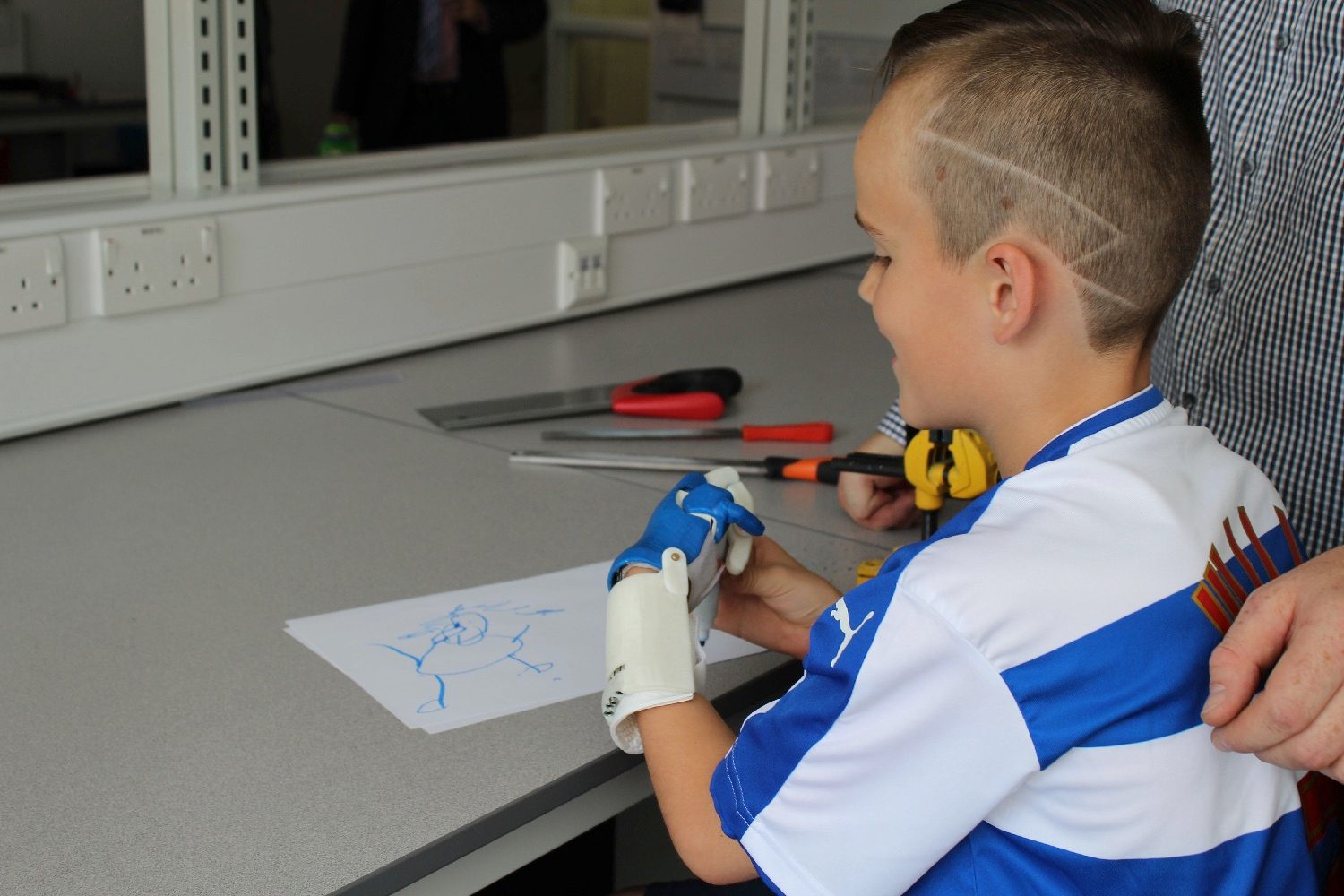 3d printed prosthesis soccer 3dprinthand2