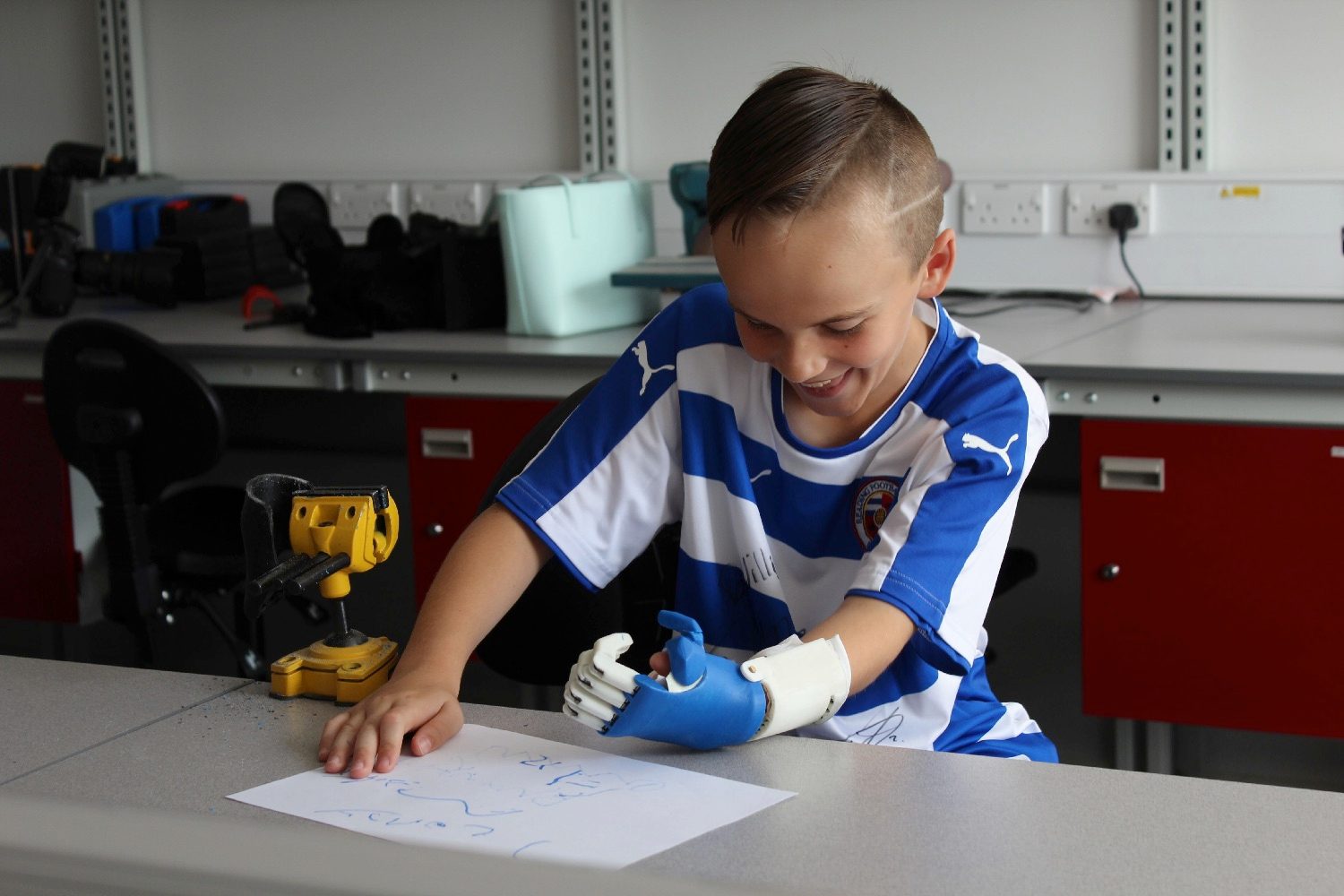 3d printed prosthesis soccer 3dprinthand3