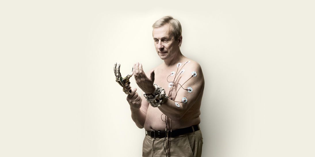 Kevin-Warwick-Project-Cyborg-DT10-Bio