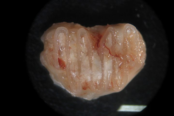 bone