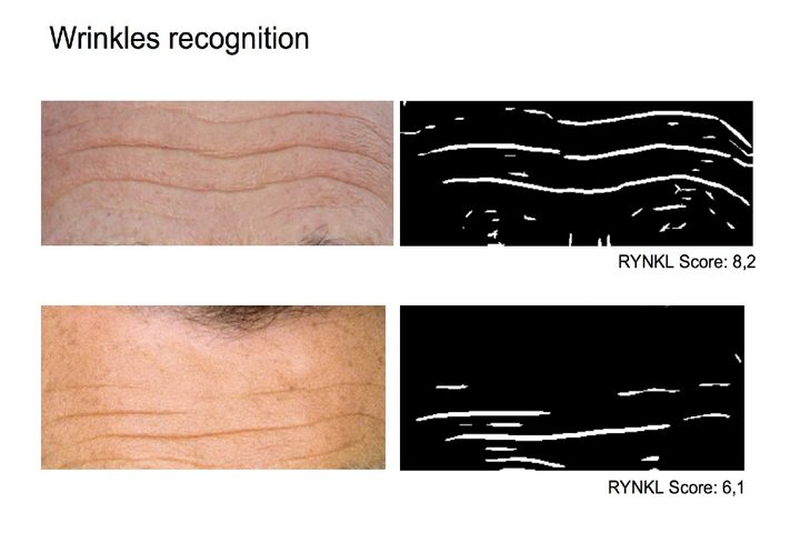 wrinkle