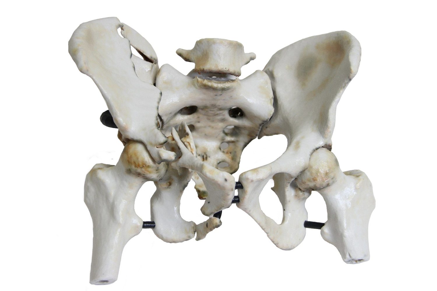 3dyourscan medical tech img 7957