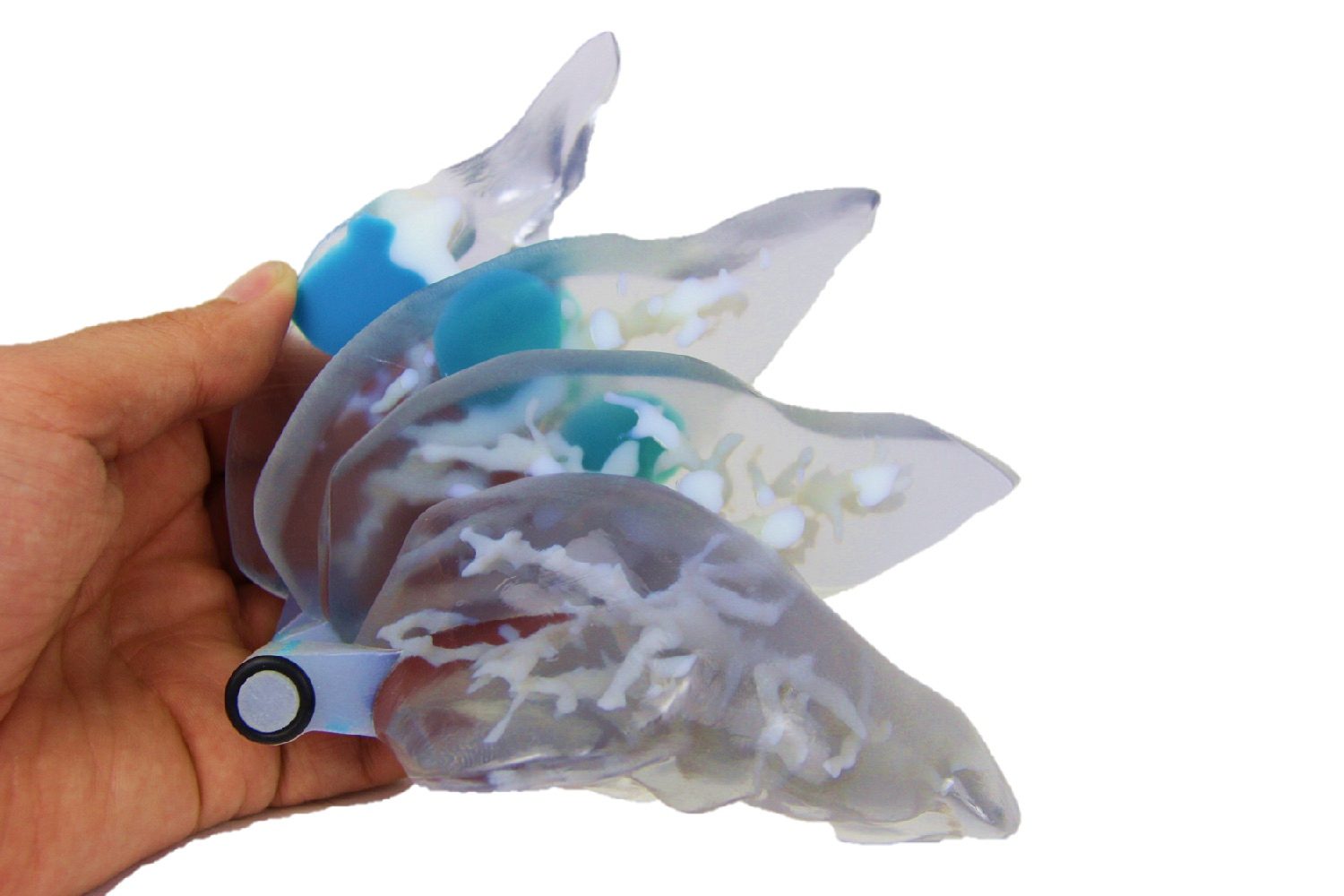 3dyourscan medical tech liver