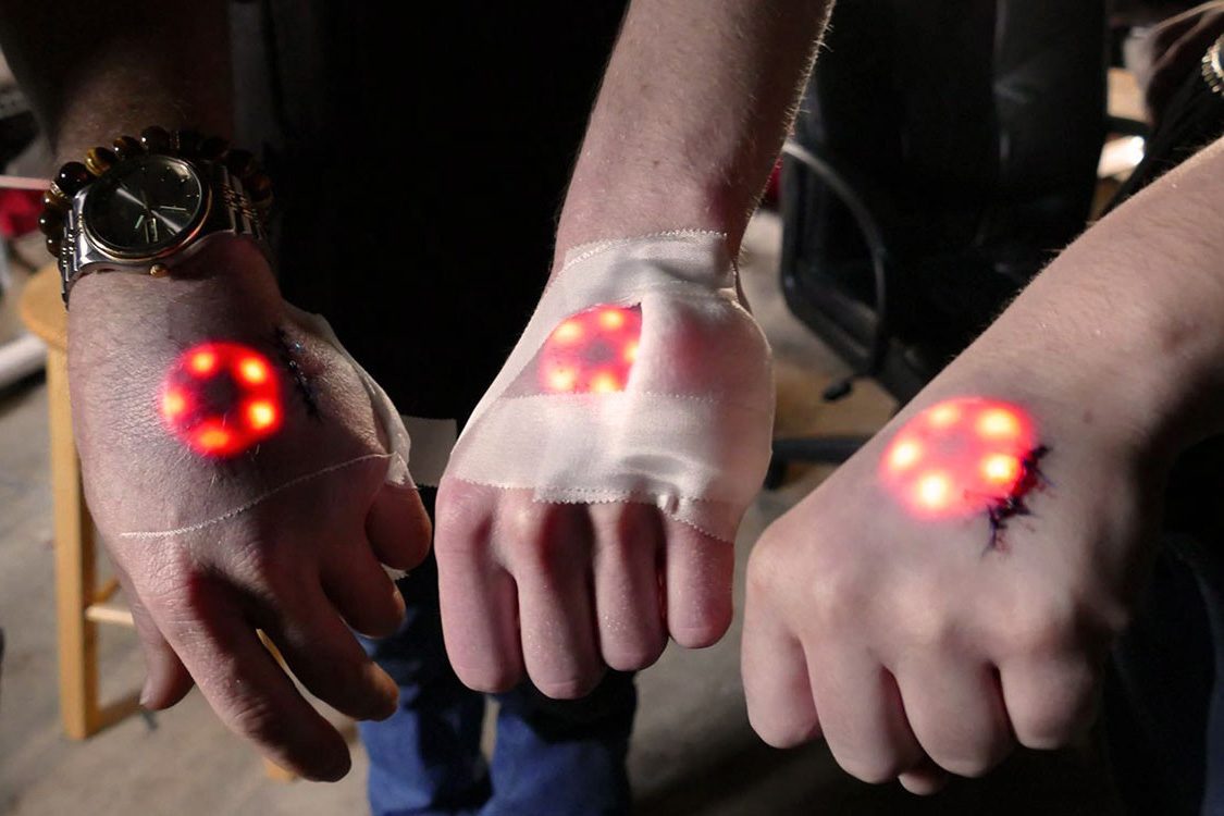 Cyborg Injection A look inside the budding battle between cyborg supply startups ...