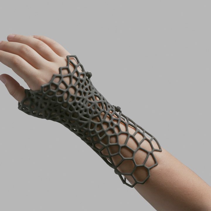 formlabs fuse1 sls printer news hand splint 2
