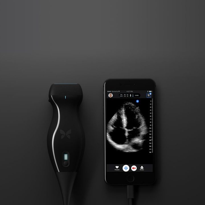 A doctor used this iPhone ultrasound machine to diagnose his own cancer