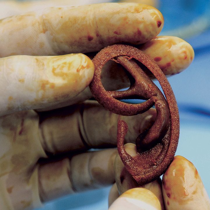 stelarc explores the possibilities of body 2 ear scaffold