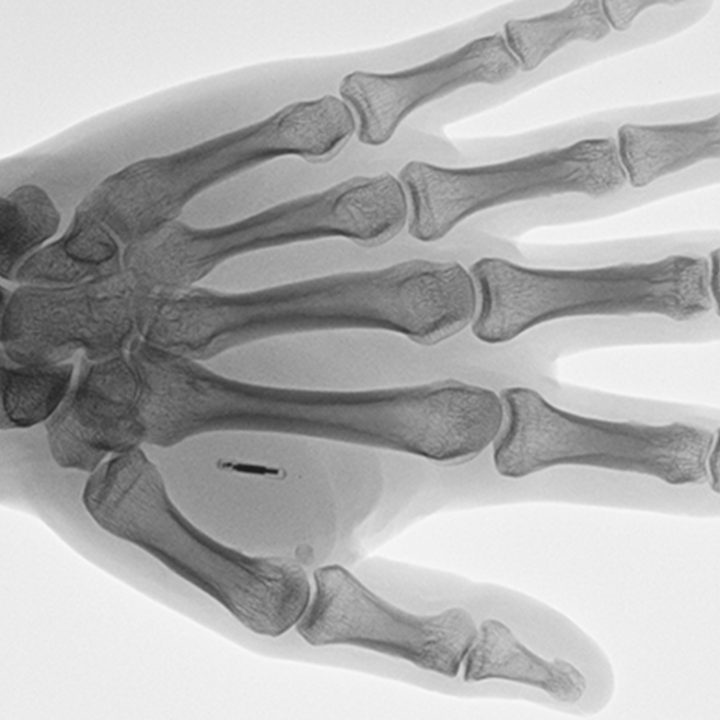 workplace microchipping next gen id company chip feat 4