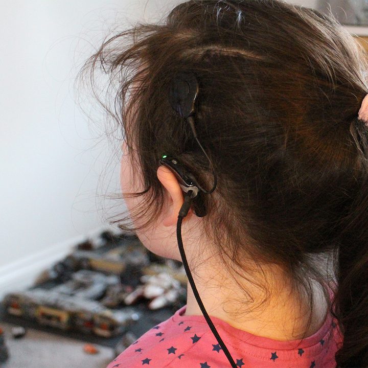girl with cochlear implants