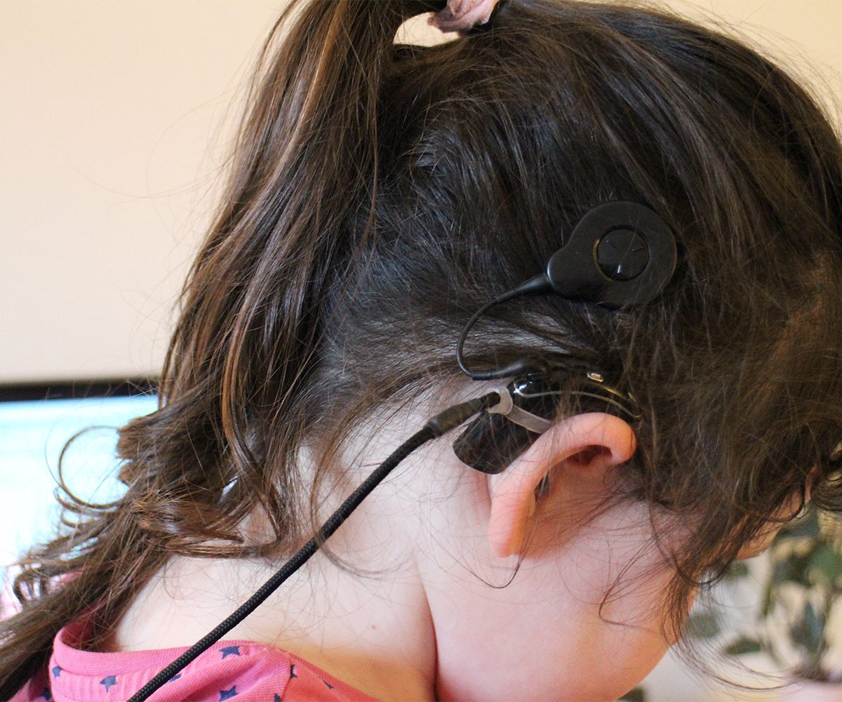 girl with cochlear implants
