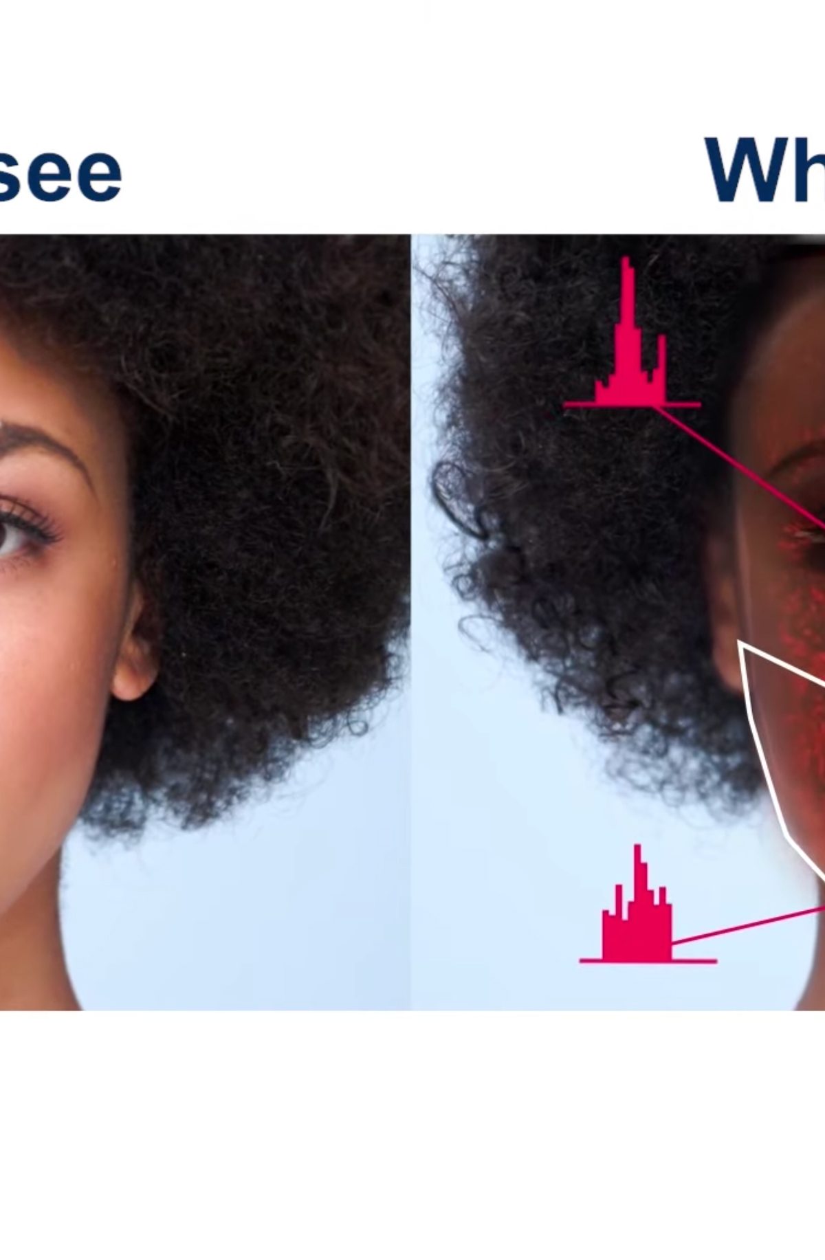What Kang Lee's Anura health app sees vs normal vision