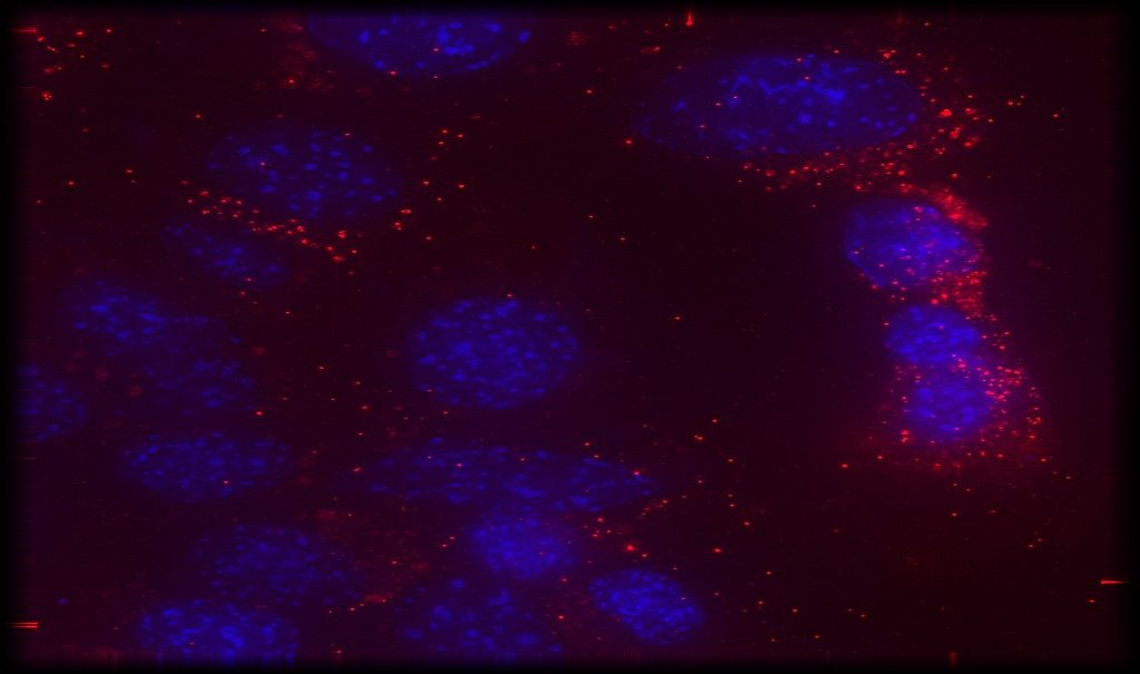 Extracellular Vesicles