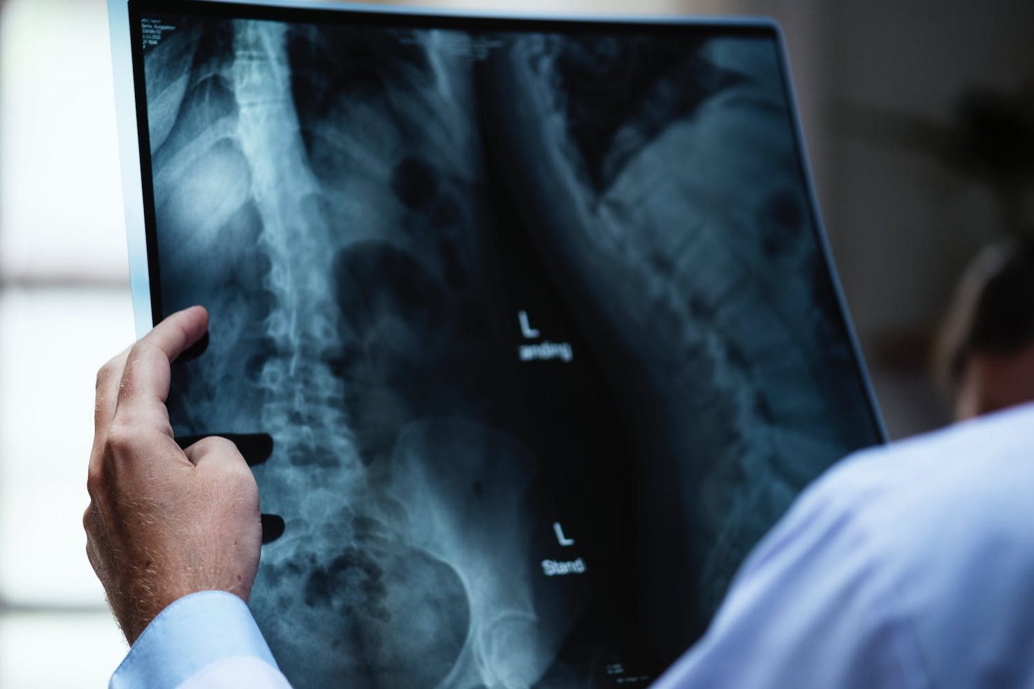 x-ray