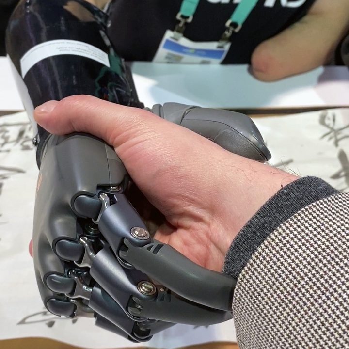 BrainCo Dexus prosthetic arm